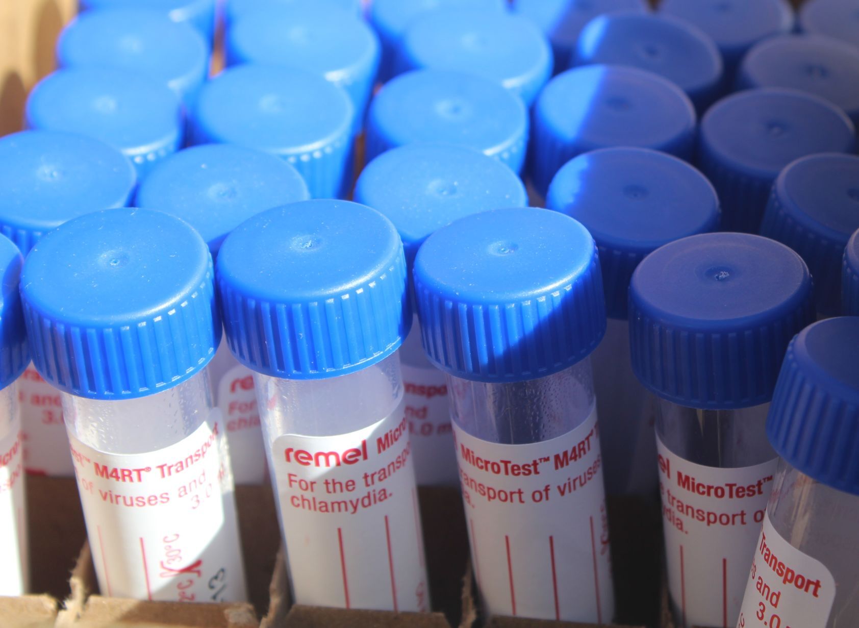 Lake County Health Department testing
